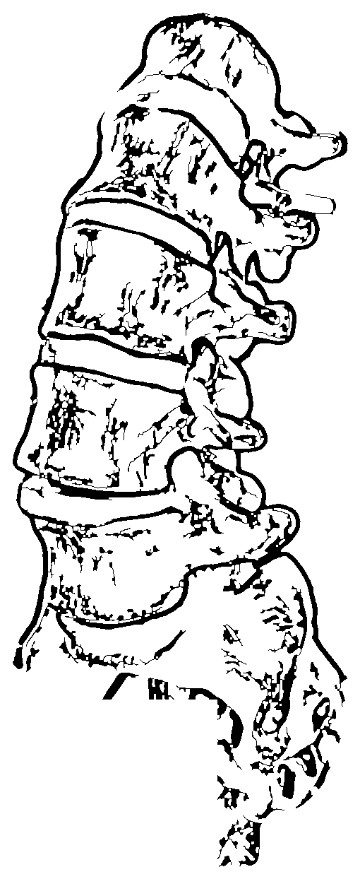 Illustration einer Wirbelsäule